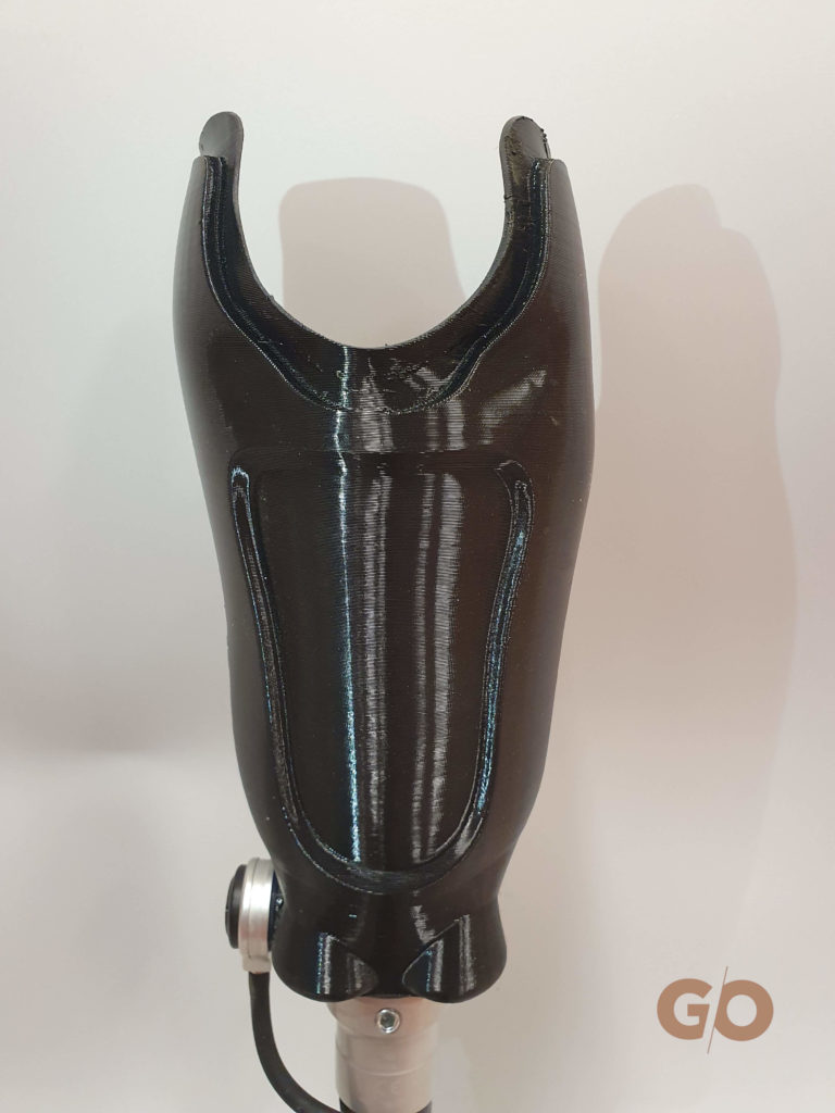 3D-Flex, une emboîture souple pour les prothèses tibiales
